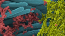 Figure 1: SARS-CoV-2 viruses (red) dispersed among the cilia (blue) and protected by the mucous (yellow), which interferes with the kill potential of antiseptic rinses.
