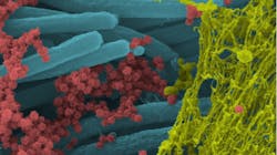 Figure 1: SARS-CoV-2 viruses (red) dispersed among the cilia (blue) and protected by the mucous (yellow), which interferes with the kill potential of antiseptic rinses. Figure 1: SARS-CoV-2 viruses (red) dispersed among the cilia (blue) and protected by the mucous (yellow), which interferes with the kill potential of antiseptic rinses.