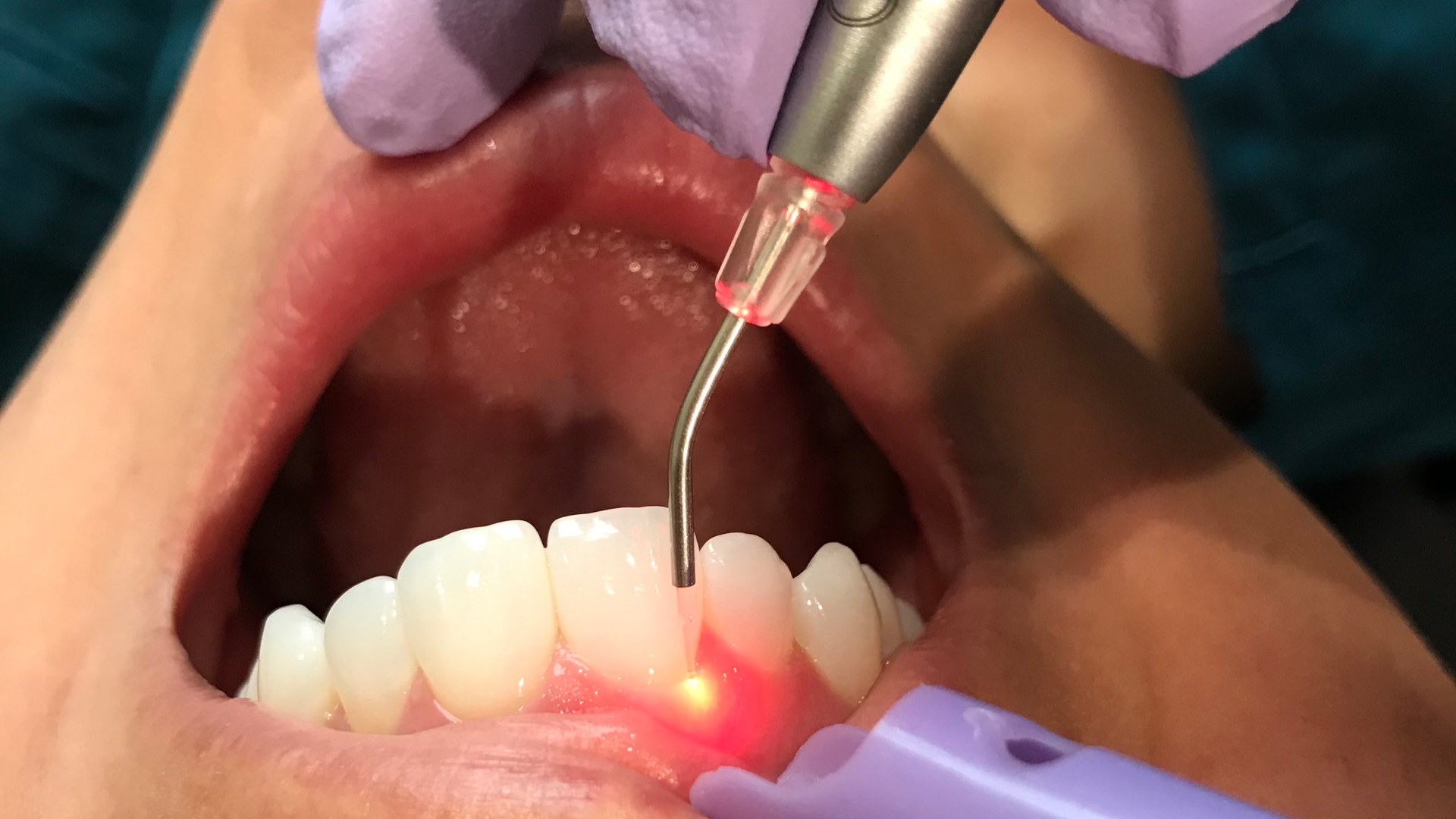 Img 3075 60c0e3bda5042