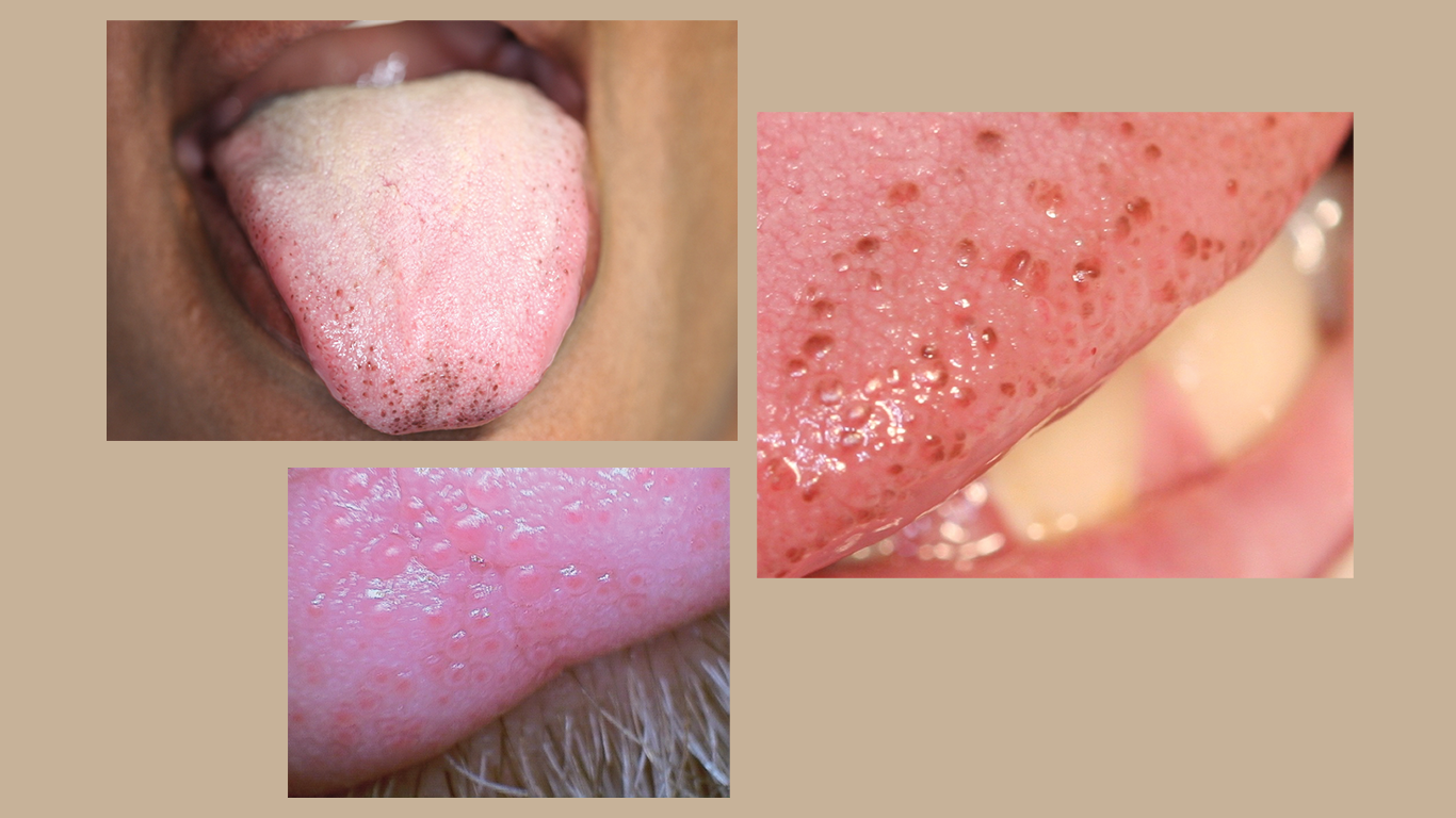 1907 Rd Hbur 60d4d3f3c9f9d