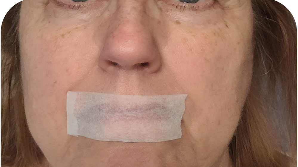 What mouth taping may look like.
