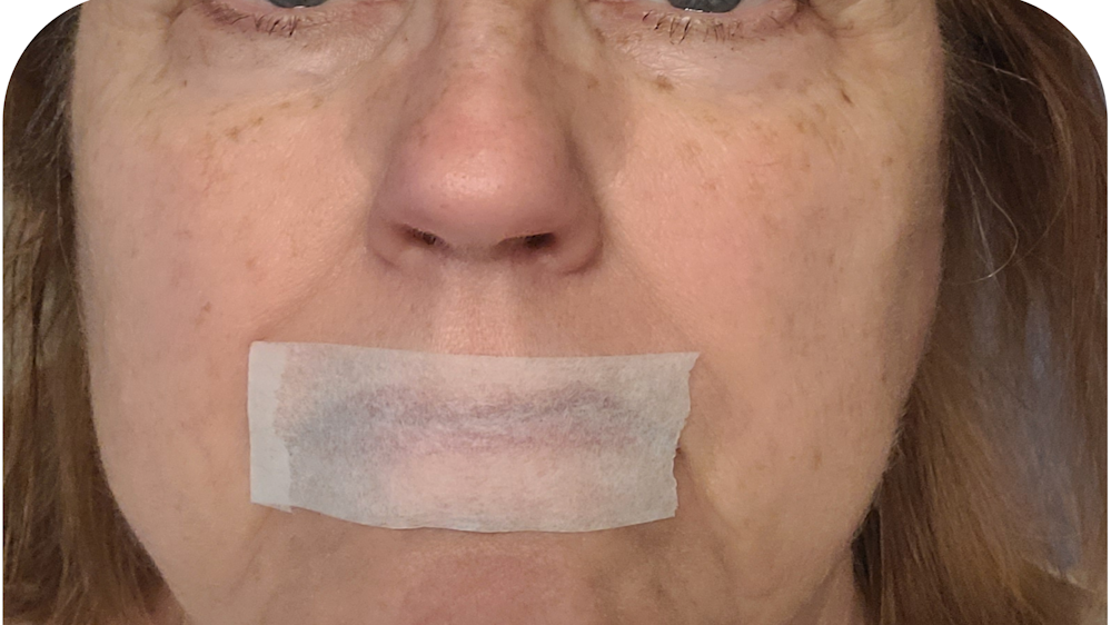 What mouth taping may look like. What mouth taping may look like.
