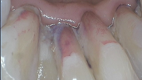 2005 Rd Hdav P02 60de15f436d8b