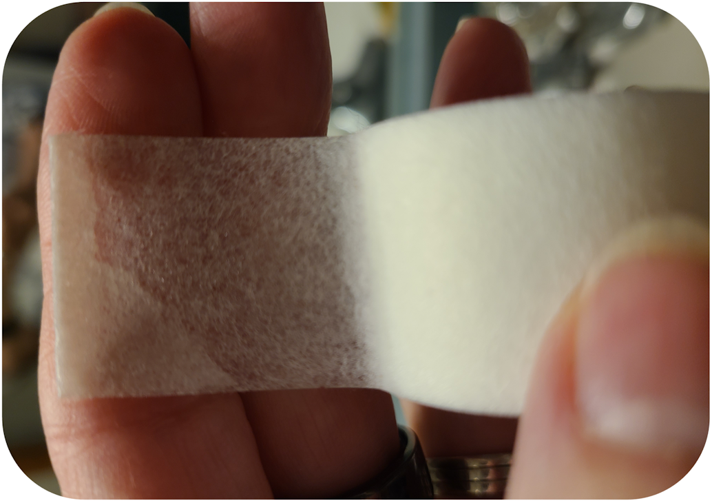 Figure 2: To practice mouth taping for sleep, fold the end of the tape over 2 to 3 mm (top). Then either tape from philtrum to chin (middle), or commisure to commisure (bottom). One-inch paper tape shown. Figure 2: To practice mouth taping for sleep, fold the end of the tape over 2 to 3 mm (top). Then either tape from philtrum to chin (middle), or commisure to commisure (bottom). One-inch paper tape shown.