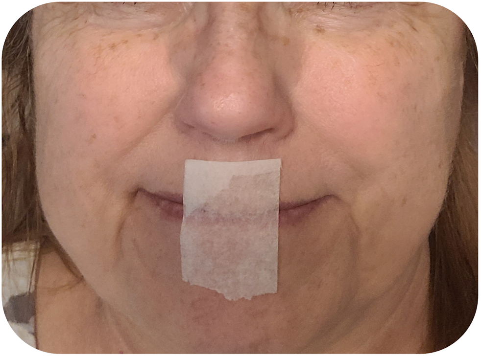 Figure 2: To practice mouth taping for sleep, fold the end of the tape over 2 to 3 mm (top). Then either tape from philtrum to chin (middle), or commisure to commisure (bottom). One-inch paper tape shown.