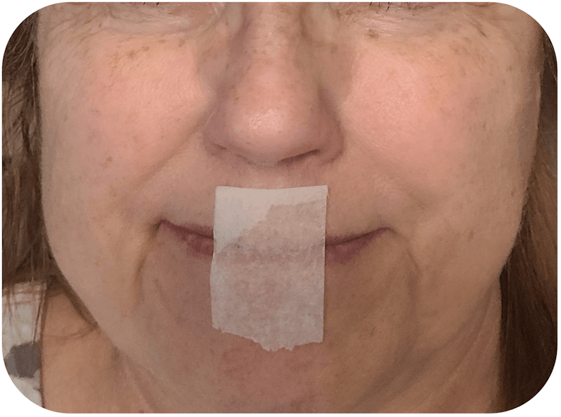 Figure 2: To practice mouth taping for sleep, fold the end of the tape over 2 to 3 mm (top). Then either tape from philtrum to chin (middle), or commisure to commisure (bottom). One-inch paper tape shown.