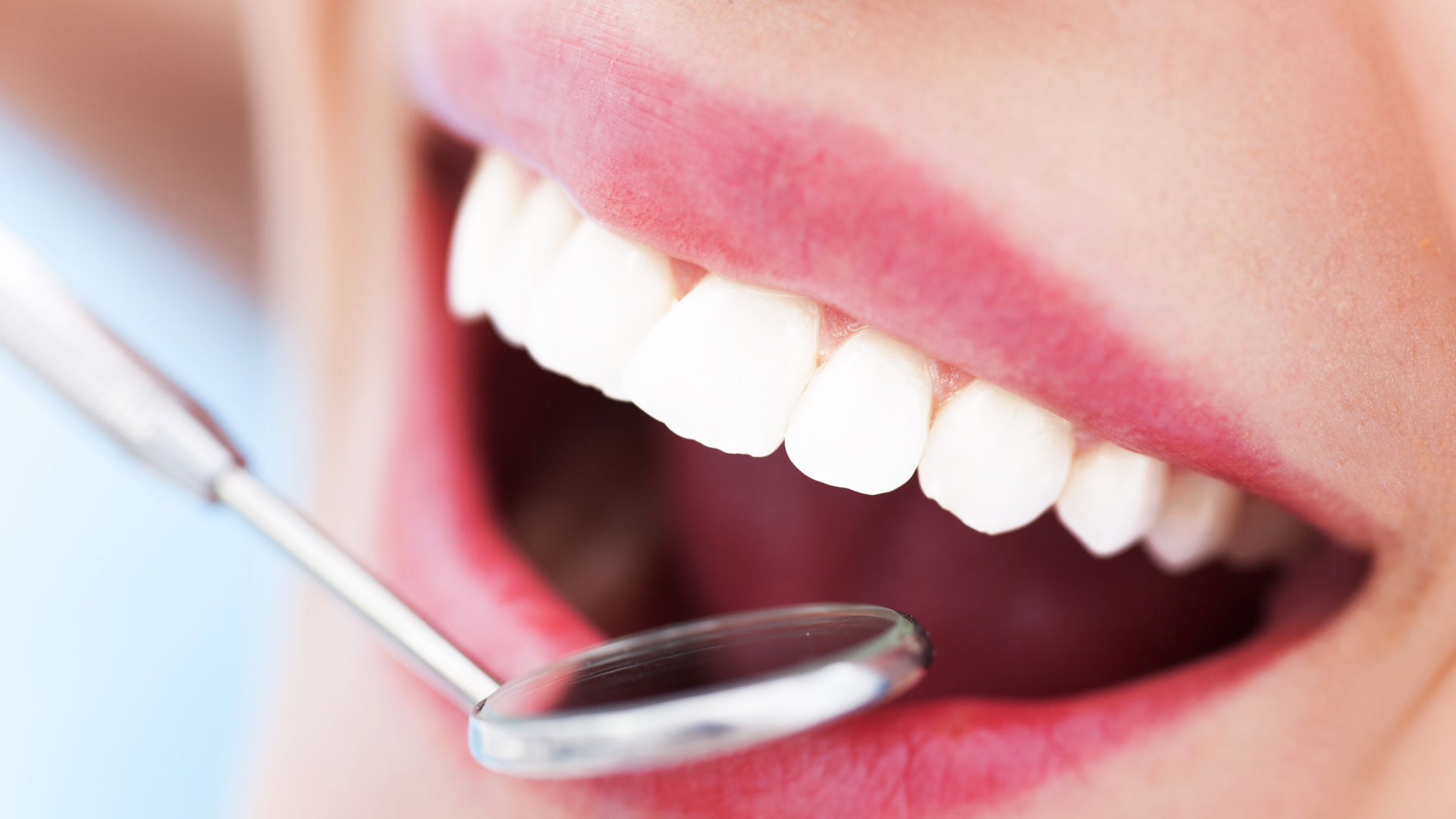 Dreamstime Xxl 36604164 611e6b8f7d840