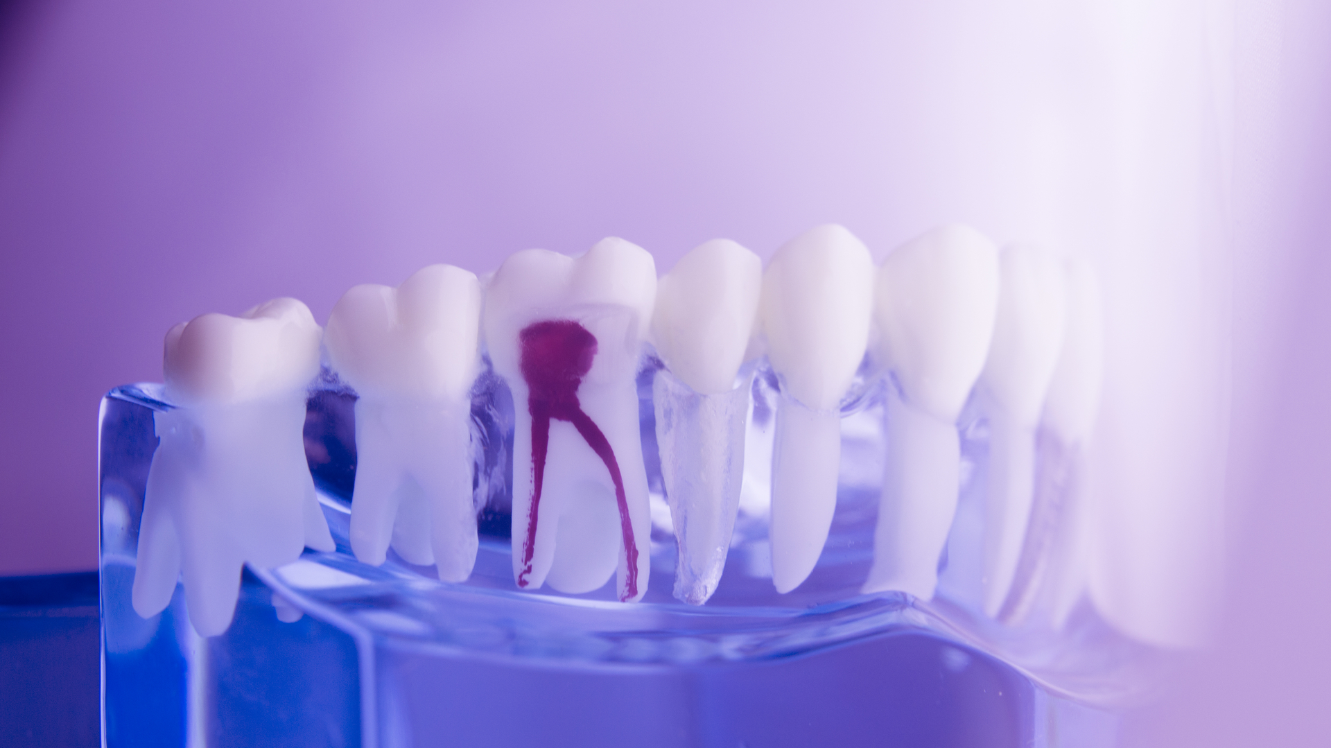 Cracking the code 5 tips on periodontal maintenance procedures
