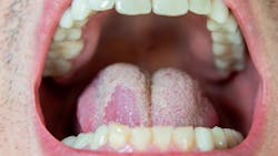 Dreamstime M 234346594 627bffdfb3af0 Dreamstime M 234346594 627bffdfb3af0