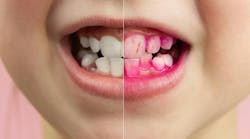 Dreamstime M 169121600 Dreamstime M 169121600