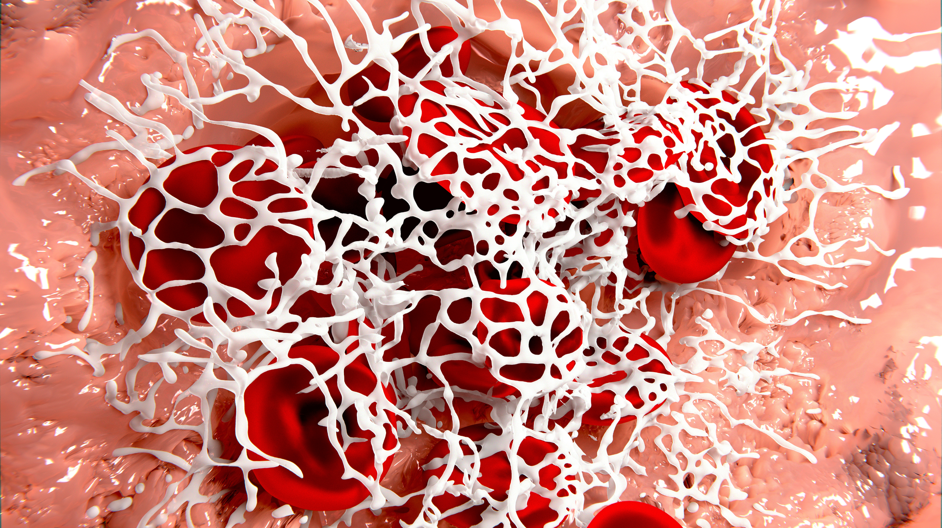 Getty Images 453858187 62f155776332c