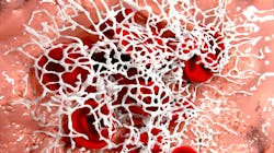 Getty Images 453858187 62f155776332c Getty Images 453858187 62f155776332c