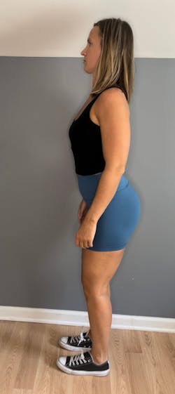 Figure 1: Core disengaged with swayback Figure 1: Core disengaged with swayback