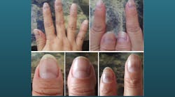 Untitled Design 33 Untitled Design 33