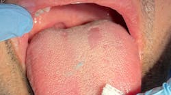 Figure 2 Gt In A 43 Y Old Male 63a1cddc9196a Figure 2 Gt In A 43 Y Old Male 63a1cddc9196a