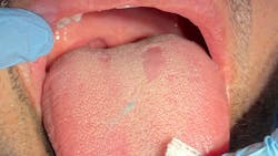 Figure 2 Gt In A 43 Y Old Male 63a1cddc9196a 63c1b3c8367d8 Figure 2 Gt In A 43 Y Old Male 63a1cddc9196a 63c1b3c8367d8