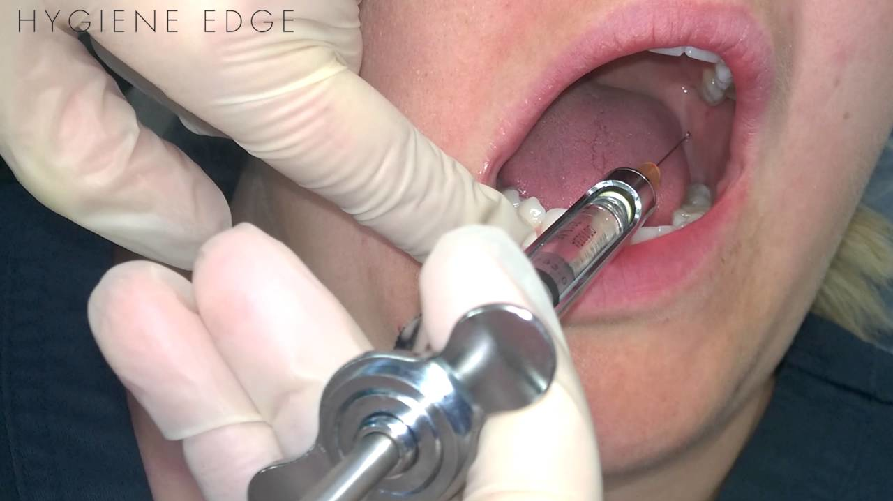 Maxresdefault 63c700a505895