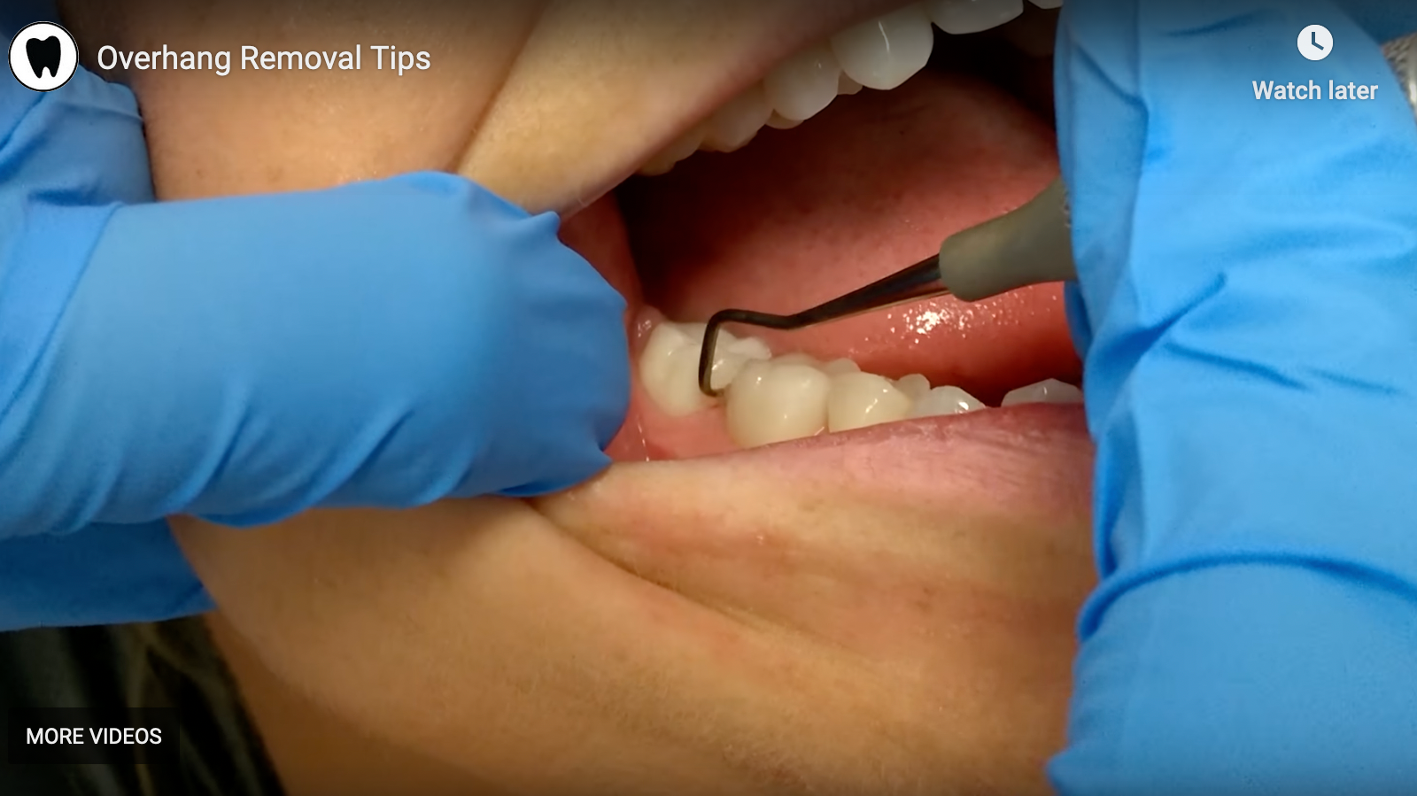 Overhang 63b740ec560e9