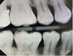 Figure 4. Good horizontal radiograph Figure 4. Good horizontal radiograph