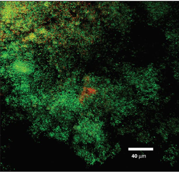 Figure 6a: Streptococcus mutans exposed to Perio Gel: live cells