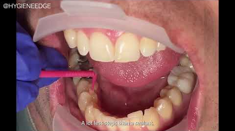 Hqdefault 64e6140995a17