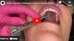 Anterior Middle Superior Alveolar Amsa Nerve Block Anterior Middle Superior Alveolar Amsa Nerve Block