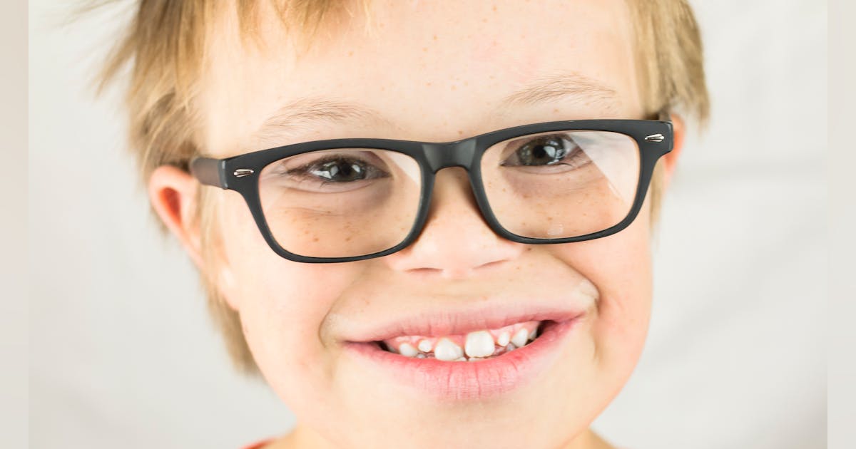 Dental care for patients with Down syndrome: Understanding the challenges and accommodations Dental care for patients with Down syndrome: Understanding the challenges and accommodations