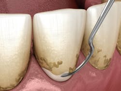 There is now indisputable evidence that the mouth contributes significantly to the systemic burden of inflammation when CIPD is inadequately managed. There is now indisputable evidence that the mouth contributes significantly to the systemic burden of inflammation when CIPD is inadequately managed.