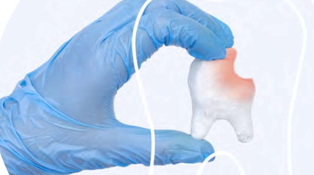 Not using silver diamine fluoride regularly? Here's why you should be