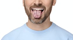 defeating-dry-mouth defeating-dry-mouth