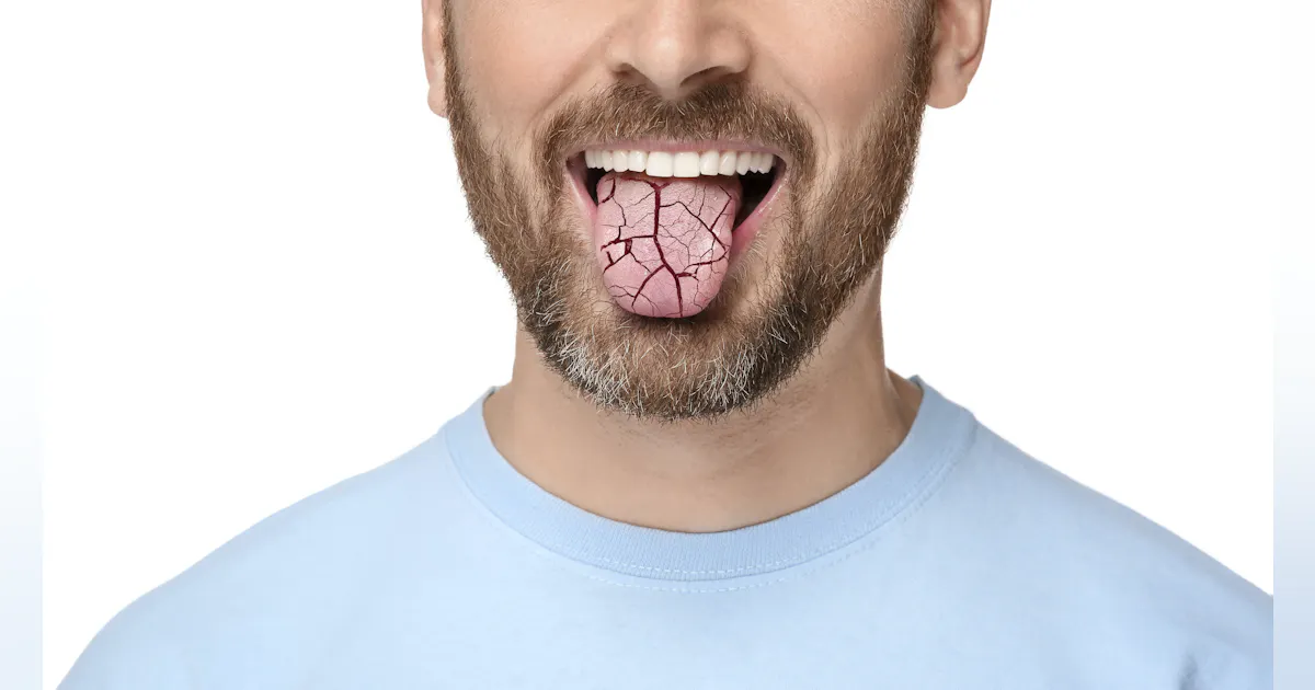 retatrutide dry mouth The Ugly Side of Weight-Loss Drugs: Rotten Breath, Damaged Teeth, and Dry Mouth Causes, Syptoms, Risk