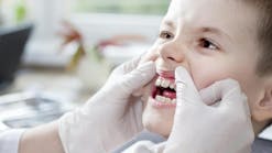 Children can develop gum disease too.