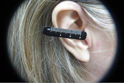 Figure 3: Basal cell carcinoma Figure 3: Basal cell carcinoma