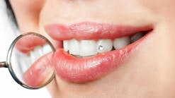Tooth gems are the new dental trend your patients may be asking about.