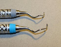 Figure 1: Instrument balance. The top instrument shows an unbalanced, retipped curette, the bottom instrument, a new balanced curette. When placed in the hand the bottom instrument does not feel heavier on one end than the other, and is bent at the correct angulation. Figure 1: Instrument balance. The top instrument shows an unbalanced, retipped curette, the bottom instrument, a new balanced curette. When placed in the hand the bottom instrument does not feel heavier on one end than the other, and is bent at the correct angulation.