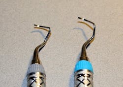 Figure 7: Cutting edge variance. The cutting edges on the curettes on the left side in both photos vary from the original design of the instrument on the right side in both photos. Figure 7: Cutting edge variance. The cutting edges on the curettes on the left side in both photos vary from the original design of the instrument on the right side in both photos.