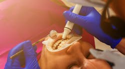 extrinsic_stain_removal_dental_hygiene extrinsic_stain_removal_dental_hygiene