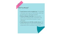 Tonsil stones fun facts Tonsil stones fun facts
