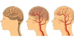 67b4c496d0e1d99d86394c5f Blood Brain 67b4c496d0e1d99d86394c5f Blood Brain
