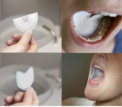Figure 1: Directa’s DryDent Parotid and Sublingual, effective alternatives to gauze and cotton rolls, designed to enhance moisture control during dental procedures. Figure 1: Directa’s DryDent Parotid and Sublingual, effective alternatives to gauze and cotton rolls, designed to enhance moisture control during dental procedures.