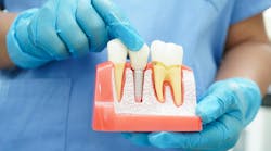 dental implant maintenance dental implant maintenance
