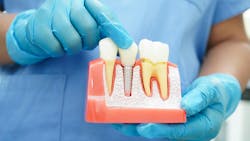 dental implant maintenance dental implant maintenance