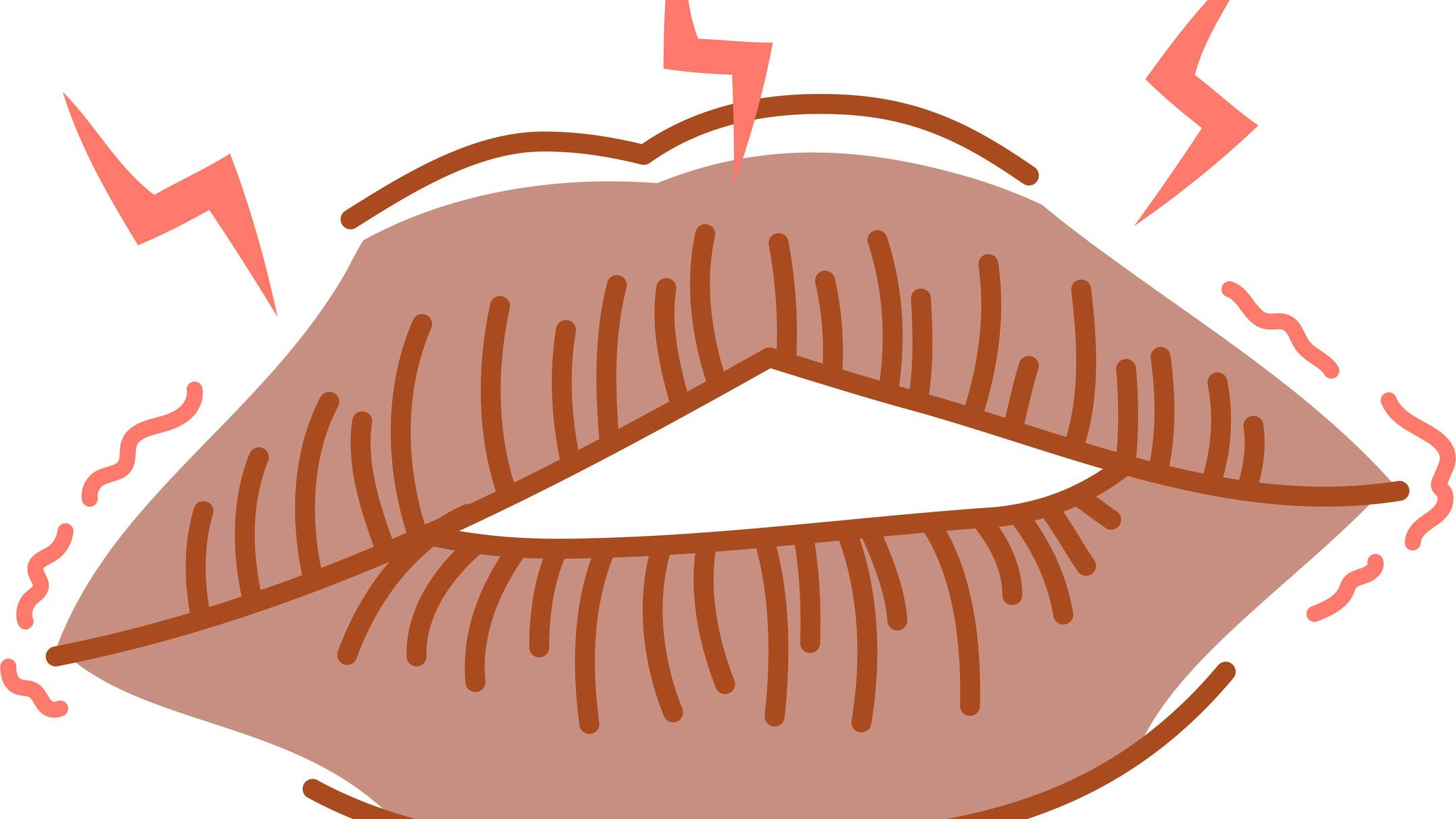 67e57b4afb8b75b8f9c19eb0 Dry Mouth Xerostomia