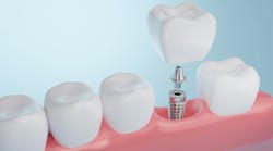dental hygienists are being trained better in dental implant maintenance but more training is needed dental hygienists are being trained better in dental implant maintenance but more training is needed