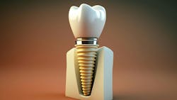 a dental implant a dental implant