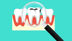 Incorporate remineralization strategies into your clinic protocols Incorporate remineralization strategies into your clinic protocols