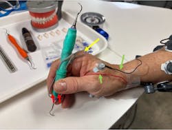 Figure 1: Tester holding test instrument with ultrathin, flexible pressure sensors affixed in the thumb and forefinger grip areas. Wires leading from the sensors to the microcontroller are visible (red arrow); the sensors (location at yellow arrows) are underneath the green sheath that is holding them in place. Some sEMG electrodes/leads are visible (green arrow). Figure 1: Tester holding test instrument with ultrathin, flexible pressure sensors affixed in the thumb and forefinger grip areas. Wires leading from the sensors to the microcontroller are visible (red arrow); the sensors (location at yellow arrows) are underneath the green sheath that is holding them in place. Some sEMG electrodes/leads are visible (green arrow).