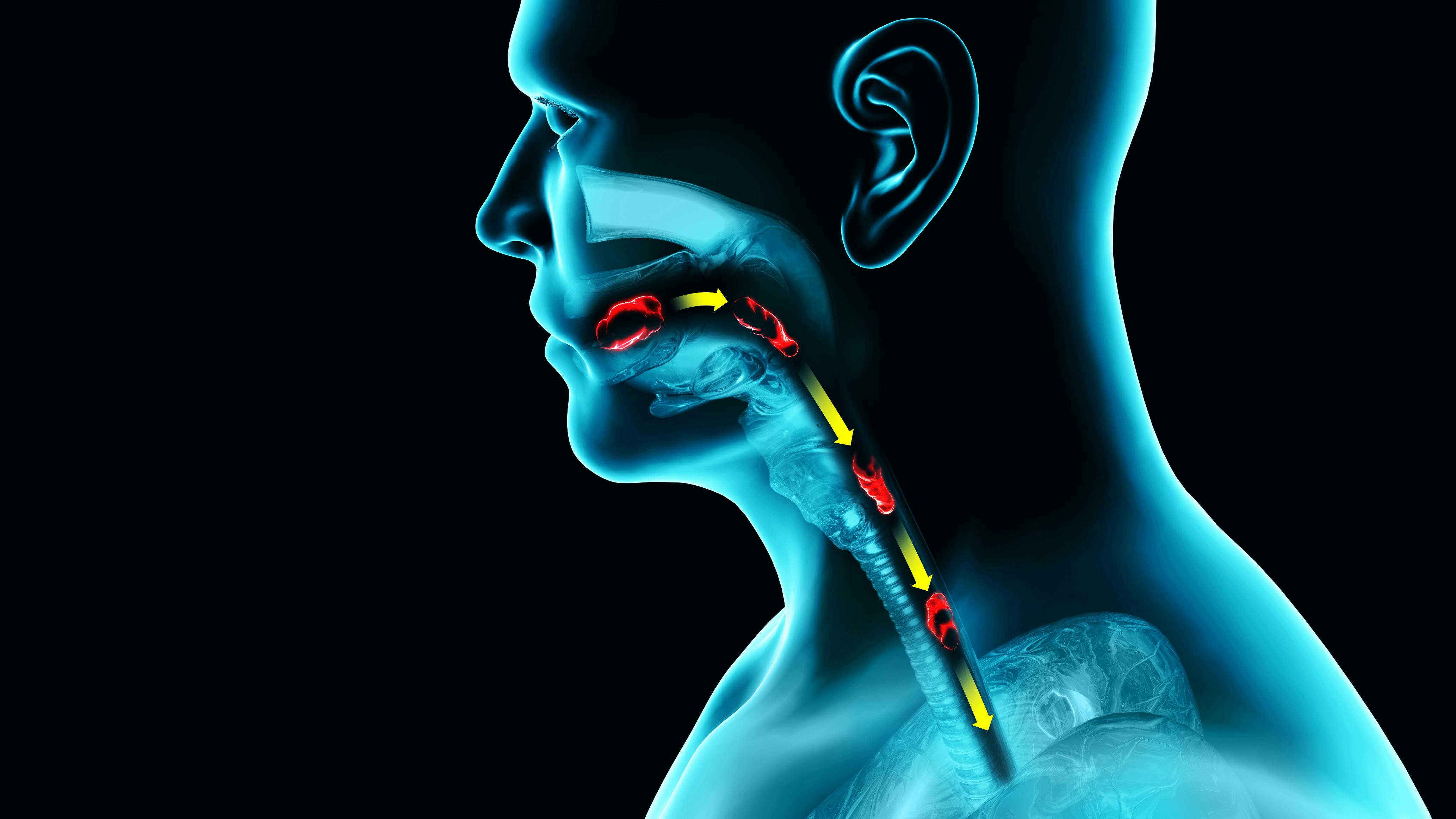 x-ray illustration of a person swallowing