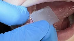 Dental hygiensits pride themselves in prevention. Dental hygiensits pride themselves in prevention.