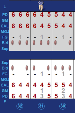 Glycine powder with subgingival nozzle debirded Nos. 30-32 4-6 mm PD. Glycine powder with subgingival nozzle debirded Nos. 30-32 4-6 mm PD.